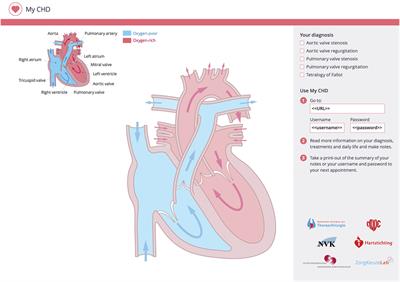 Development of an Online, Evidence-Based Patient Information Portal for Congenital Heart Disease: A Pilot Study